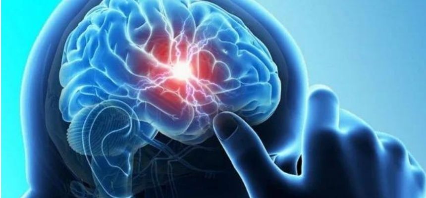 LIFE SAVING MECHANICAL THROMBECTOMY FOR ACUTE BRAIN STROKES