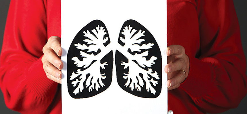 Target Therapyâ€“A new horizon in lung cancer treatment