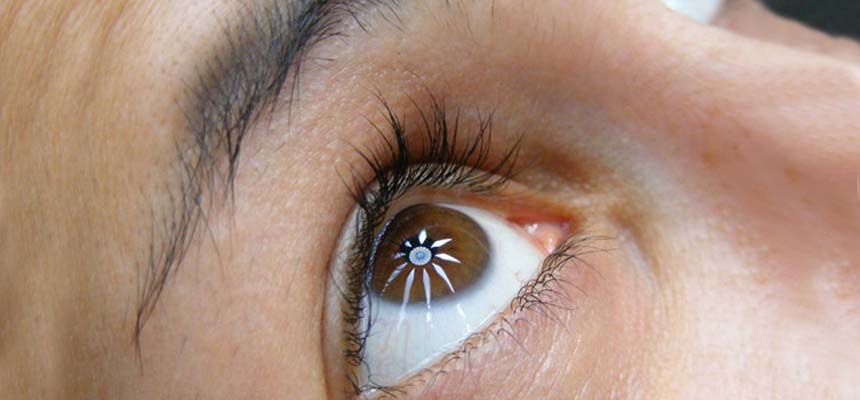 Excess Vitamin A and Stargardt disease