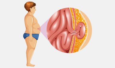 67-Year-Old Man With A Large Complicated Hernia Successfully Treated  Apollo Spectra, Pune