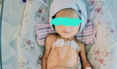 AINU Doctors Perform Life-Saving Surgery on Premature Infant