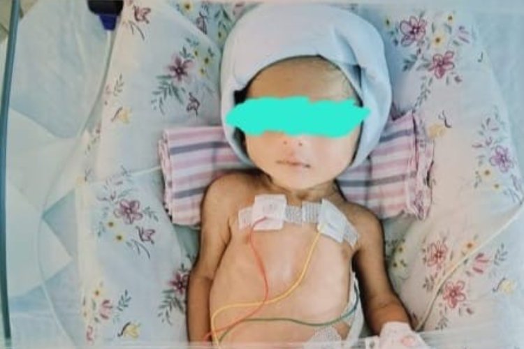 AINU Doctors Perform Life-Saving Surgery on Premature Infant