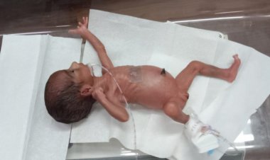 Apollo Cradle gives extreme preterm baby a fighting chance: A case of hope and resilience