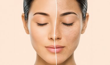 Drive away dry skin !