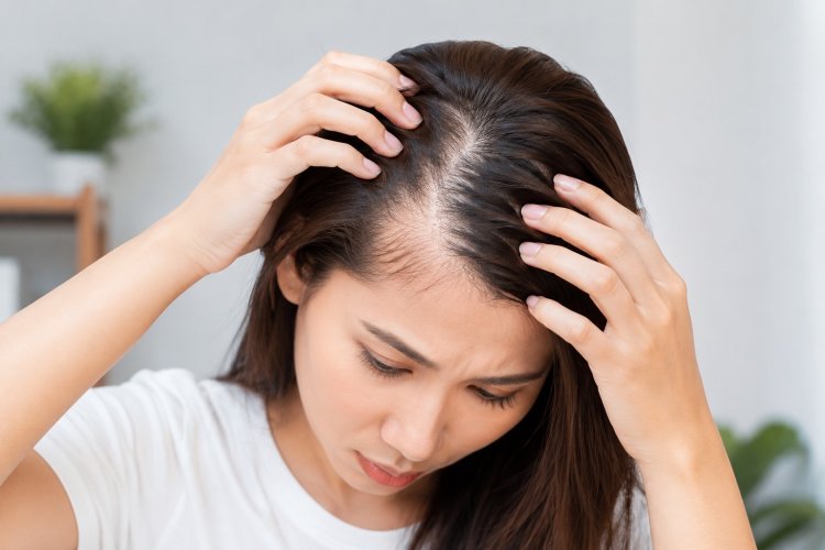 THE CAUSES OF FEMALE PATTERN BALDNESS