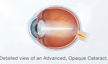 Are Indians at a higher risk of getting cataracts?